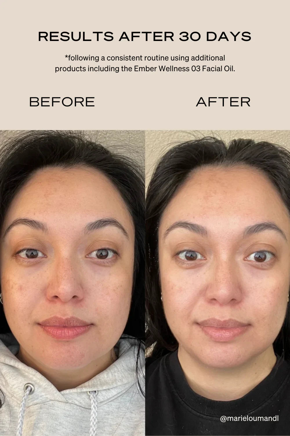 The Rejuvenating Light Therapy Mask Accessories Ember Wellness