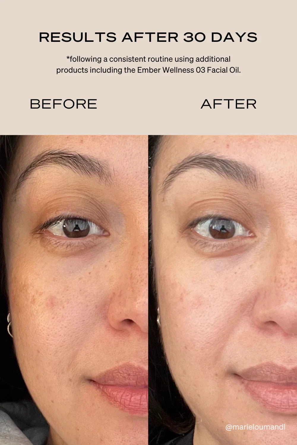 The Rejuvenating Light Therapy Mask Accessories Ember Wellness